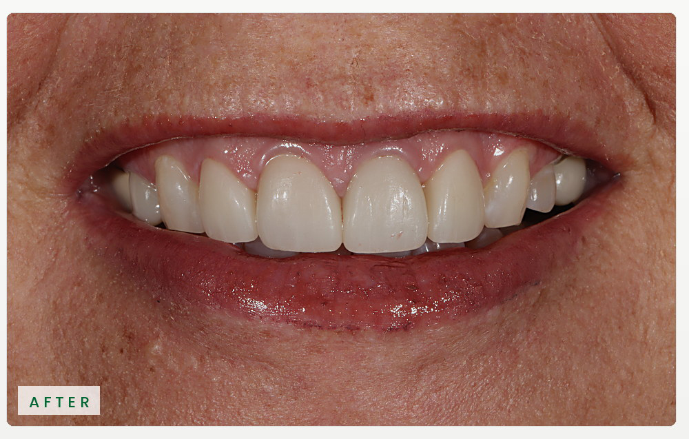 Case-04-Karen_website_horizontal_RiverOaks_After