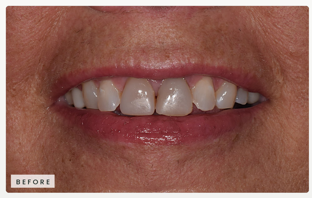 Case-04-Karen_website_horizontal_RiverOaks_Before