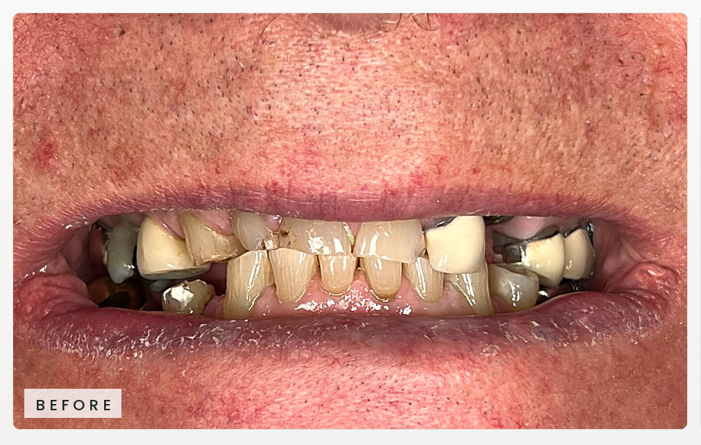 Case-06-Jim_website_horizontal_RiverOaks_Before