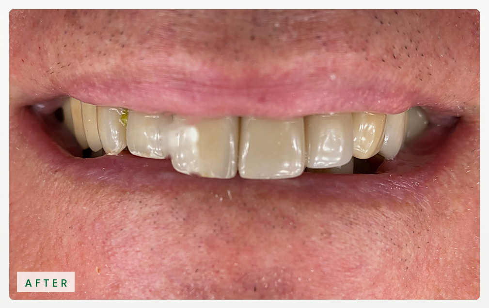 Case-08-LongToothGuy_website_horizontal_RiverOaks_After
