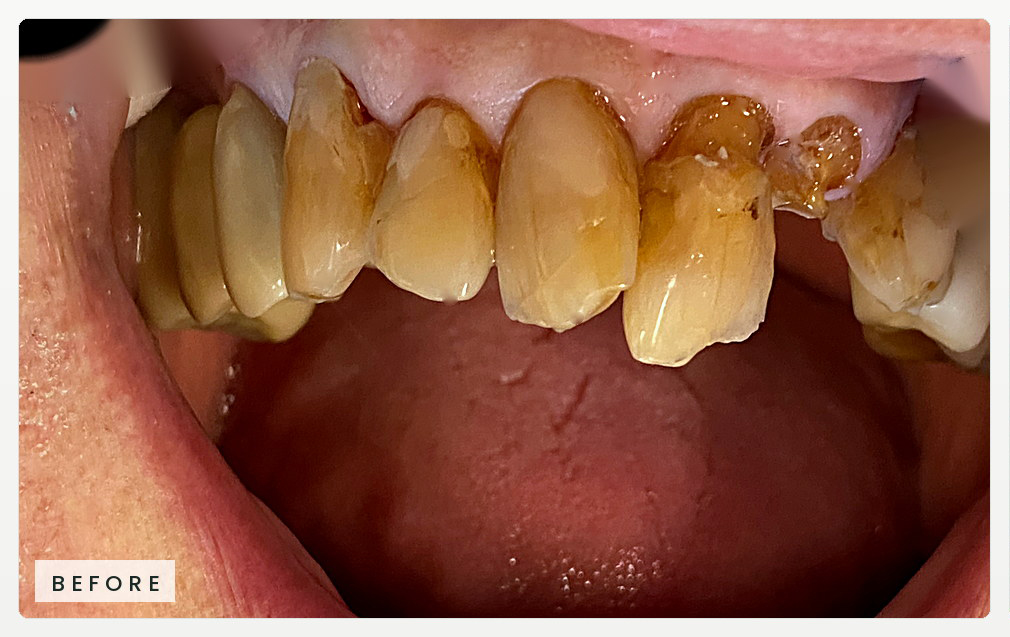 Case-08-LongToothGuy_website_horizontal_RiverOaks_Before